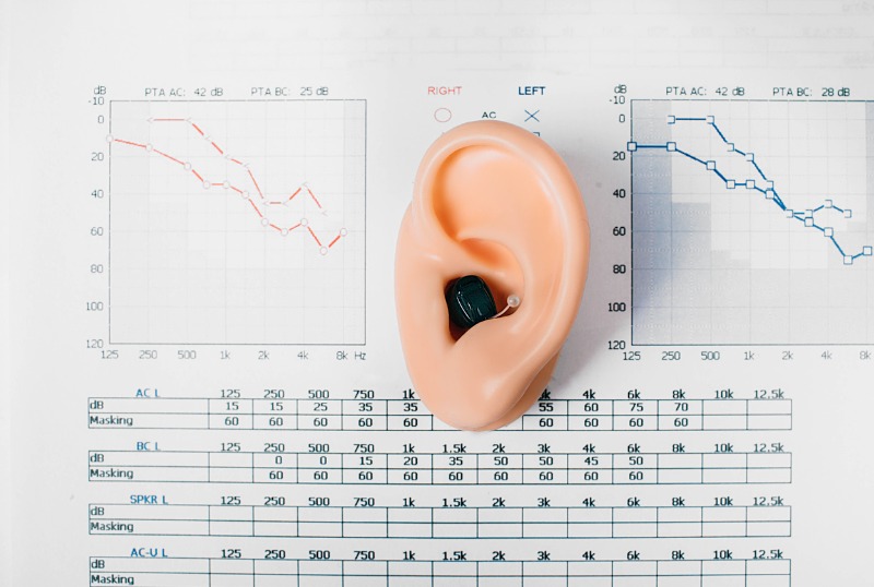 You are currently viewing Qu’est-ce qu’un audiogramme ?